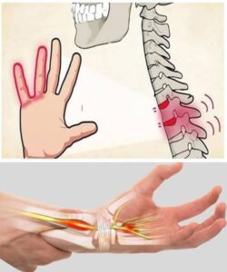 Numb Hands: Is It Normal or a Sign of a Problem?