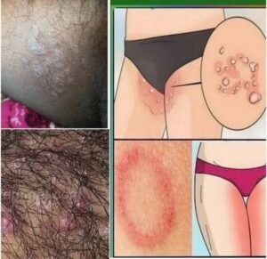 HT10. All the Symptoms of Stomach Cancer