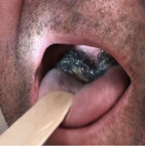 Be careful! These are the consequences of sleeping with the…
